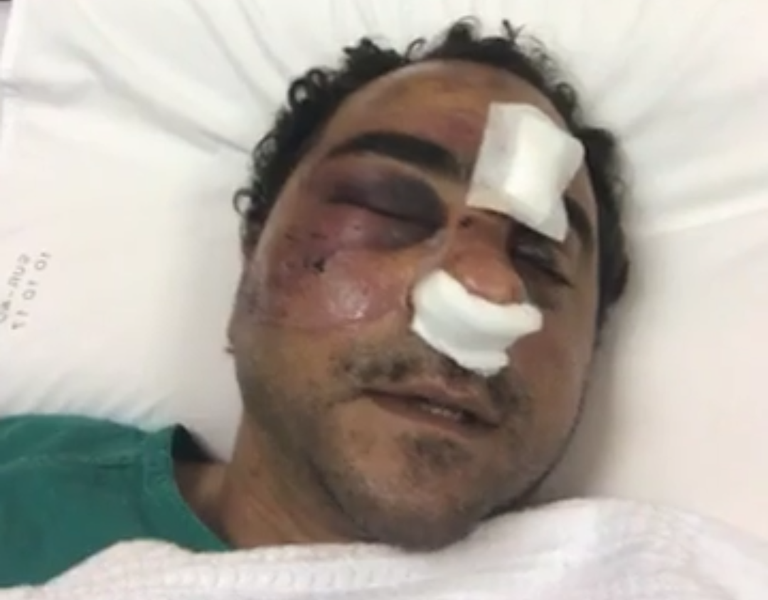 وحيد محمود الذي تم الإعتداء علية بالكويت بالمستشفى